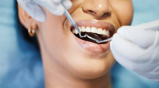 Best Emergency Broken Tooth Repair in Fountain Hill, PA
